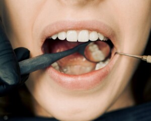Endodontie - Centre Dentaire Beauport